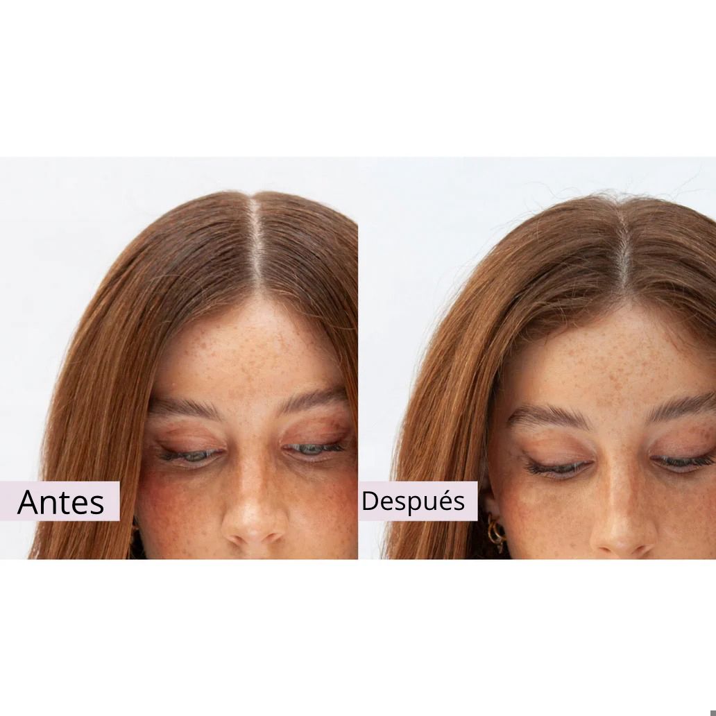 Antes y despu&eacute;s Peptide Puff 2